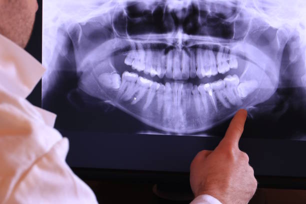 Best Same-Day Emergency Dentist in Georgetown, DE